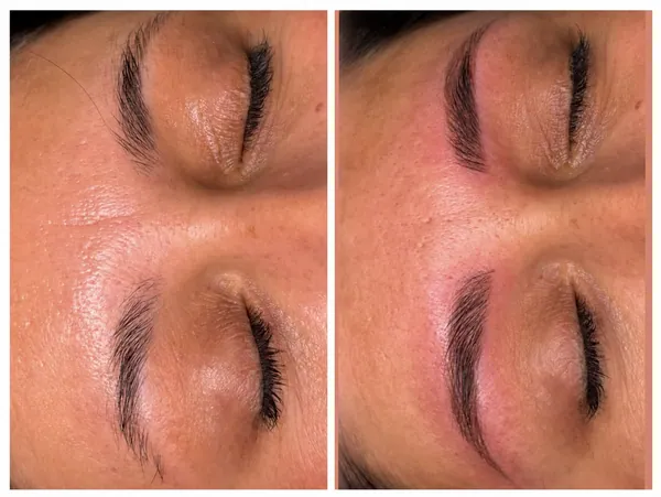 Microblading înainte și după, lucrarea 1