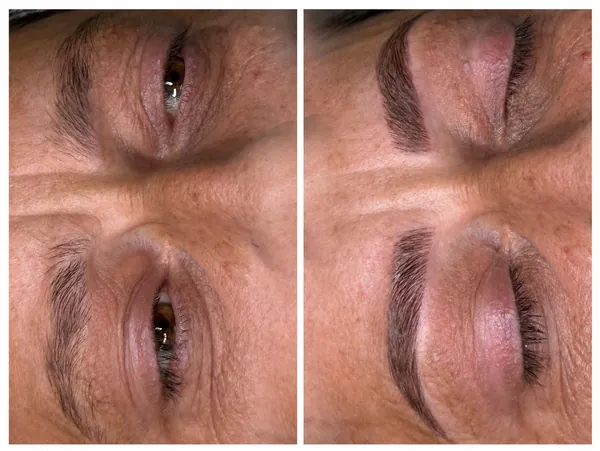 Microblading înainte și după, lucrarea 3